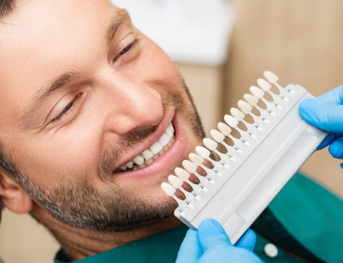 Porcelain Veneers: What You Need To Know
