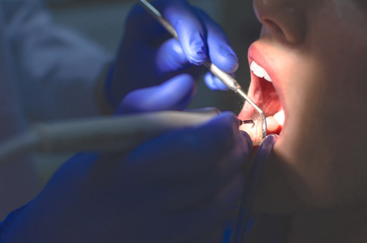 Salo & Salo - Dental Procedure